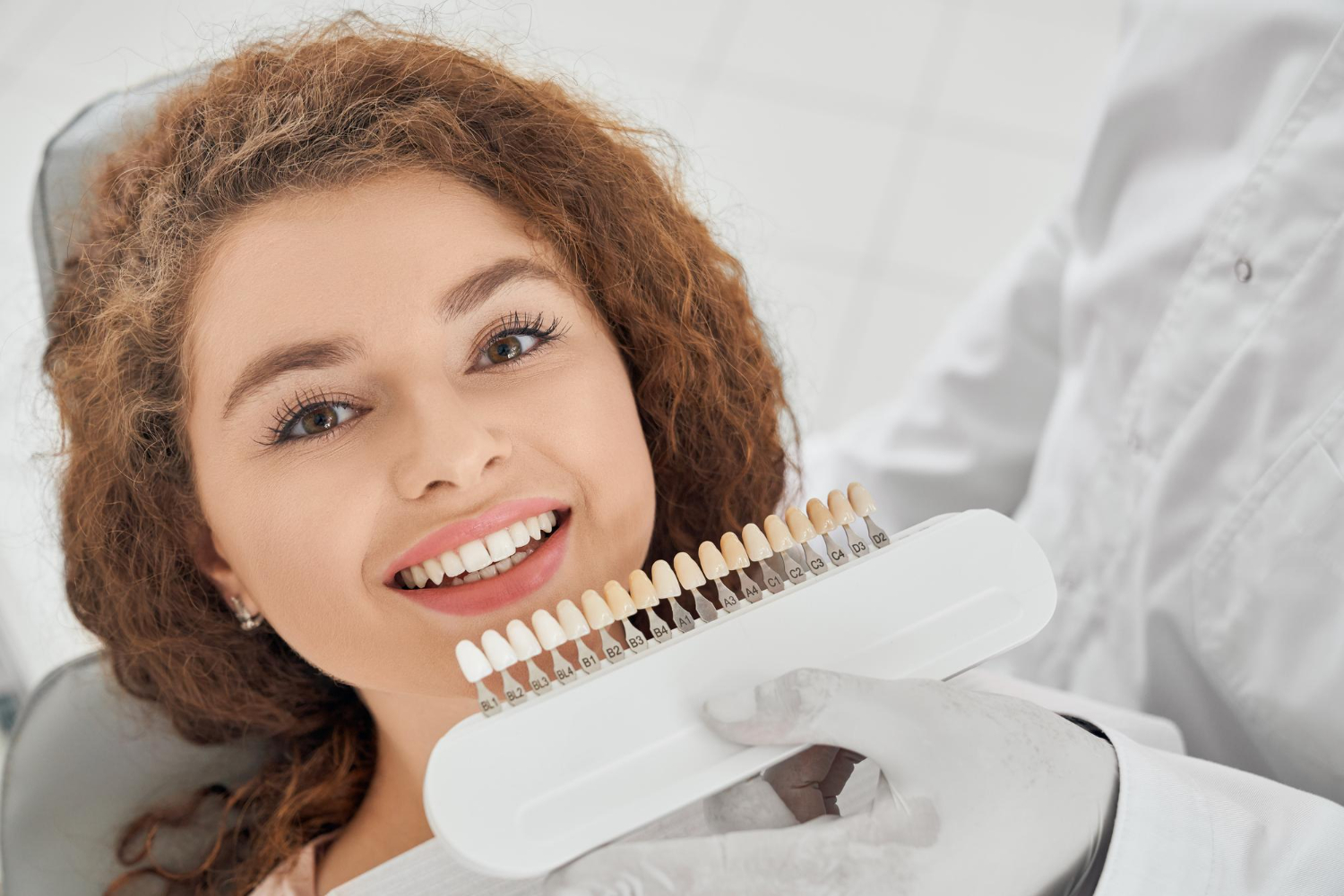 Carillas dentales: la solución estética que está revolucionando la odontología moderna